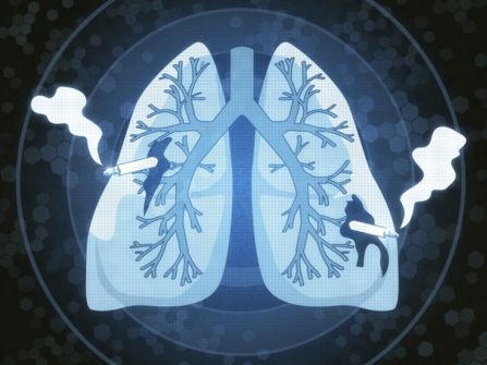 肺癌初期可以治愈么？怎么确诊肺癌是早期还是晚期?