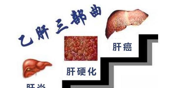 肝癌早期会消瘦吗 肝癌早期肝功能有什么异常吗？